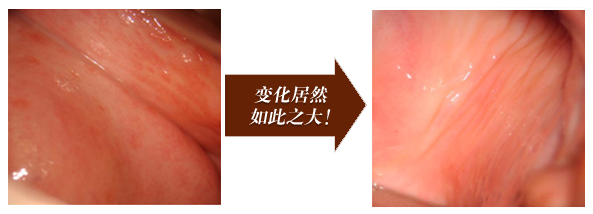 变化居然如此之大!